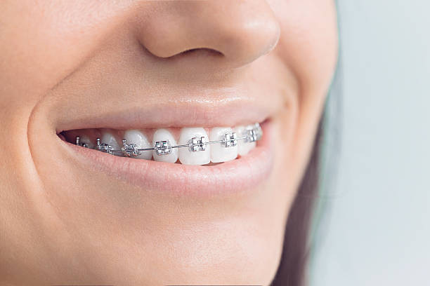 Dental Inlays and Onlays in Walnut, IL